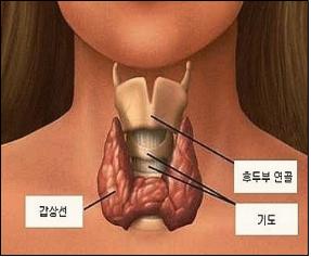중년 위협하는 갑상선염 증상과 예방법 [건강상식] 한국..