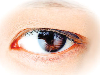 봄철 눈 건강 적신호 ‘알레르기 결막염’ [건강상식] ..