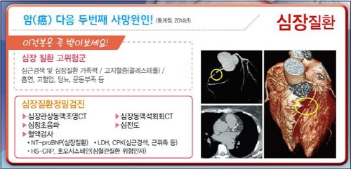 몸 안의 방아쇠, 혈관질환 [건강상식] 한국건강관리협회..
