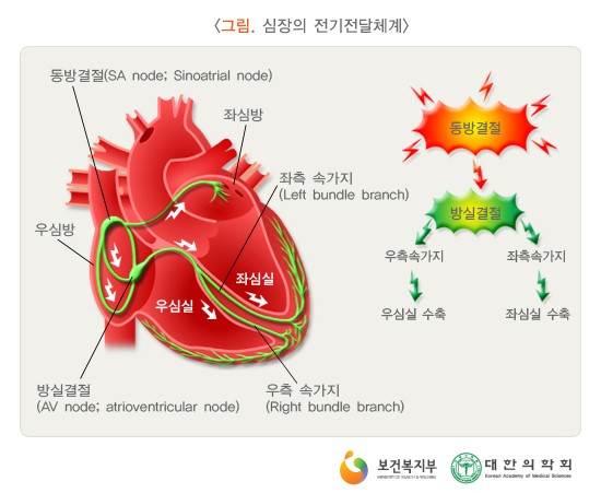 부정맥 바르고 정확하게 알기